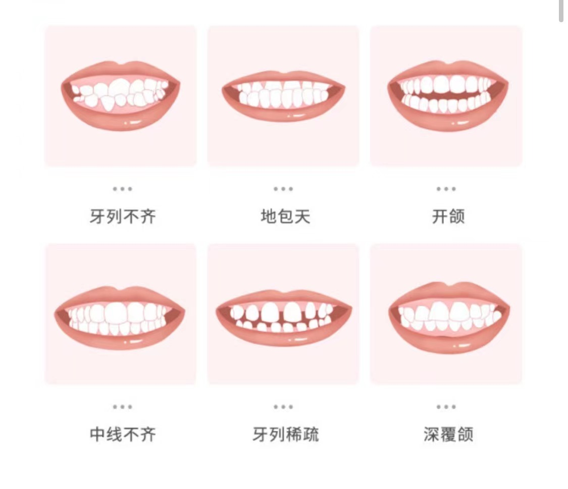 牙齿矫正